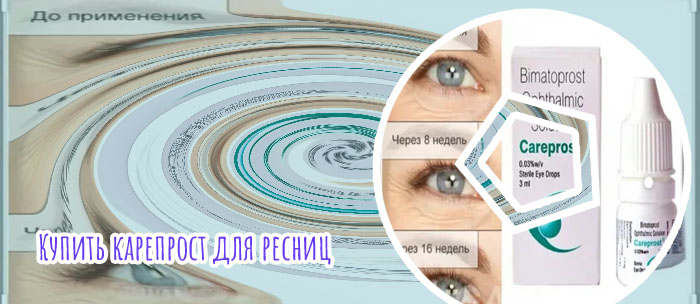Карепрост для ресниц купить цена