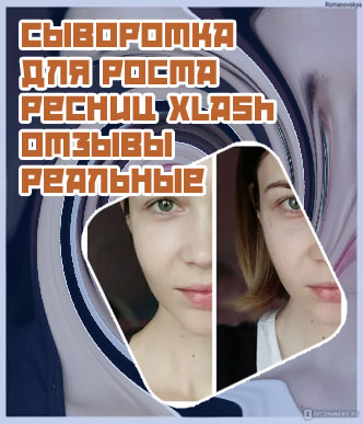Топлаш сыворотка для ресниц отзывы реальные